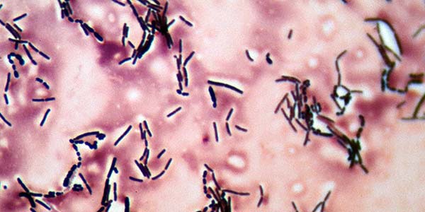 DIY Biotech: Harnessing Bacteria for Fermentation